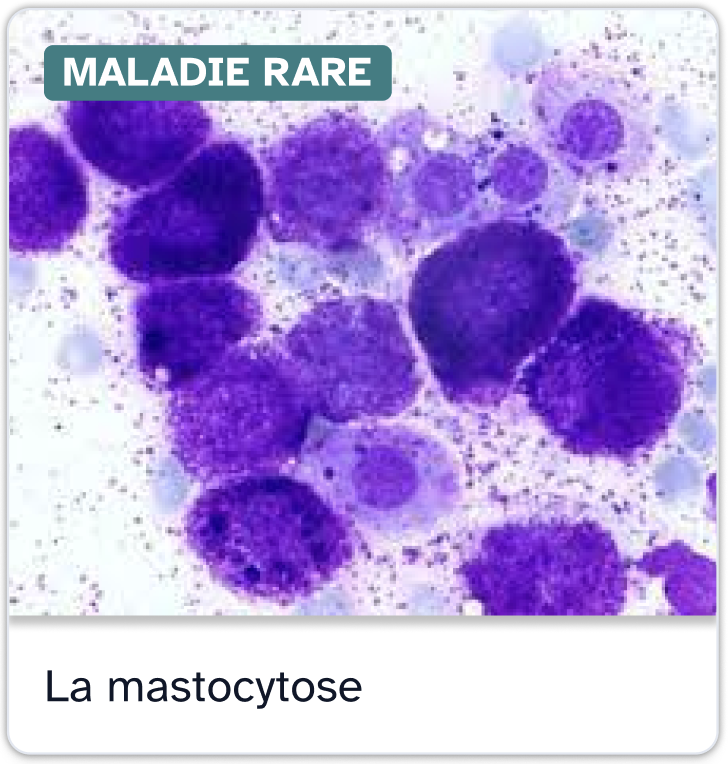 Fiche information maladie rare