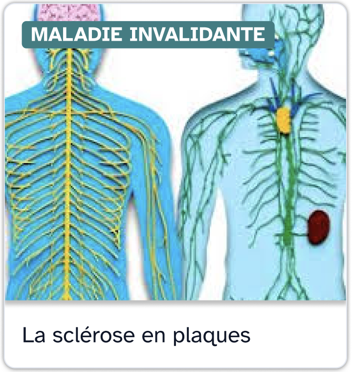 Fiche information sclerose en plaques