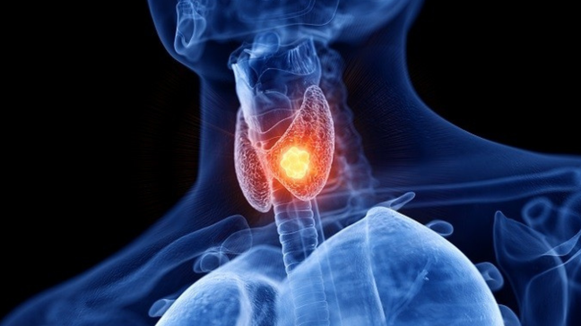 Hyperthyroïdie