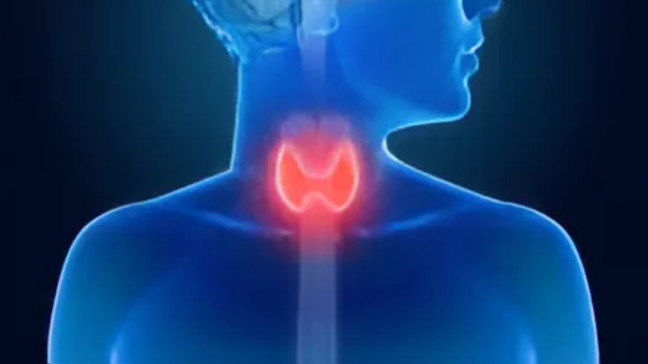 Hypothyroidie