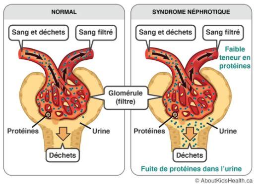 Nephro 2