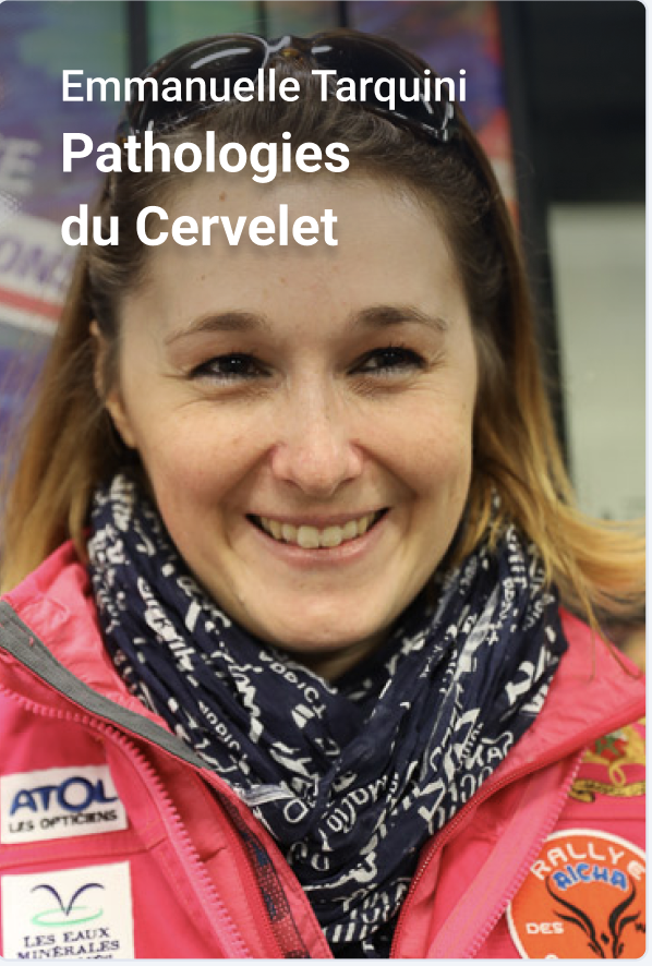 Pathologie cervelet drawyourfight