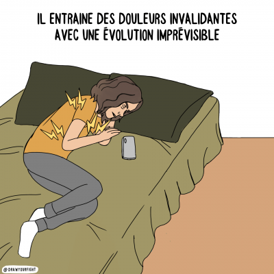 Le SDRC est associé à des douleurs chroniques invalidantes et imprévisibles