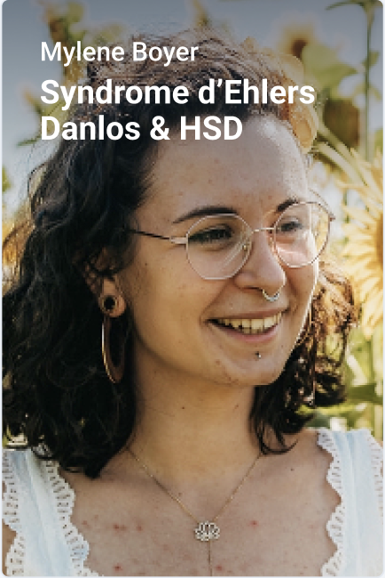 Syndrome ehlers danlos