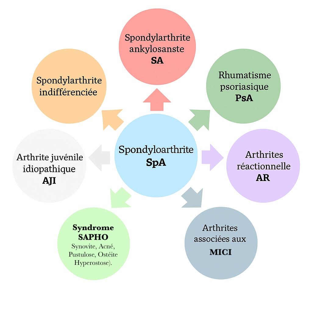 Types de spondylarthrites